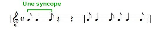 la syncope, exemple sonore