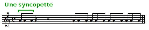 la syncopette, exemple sonore